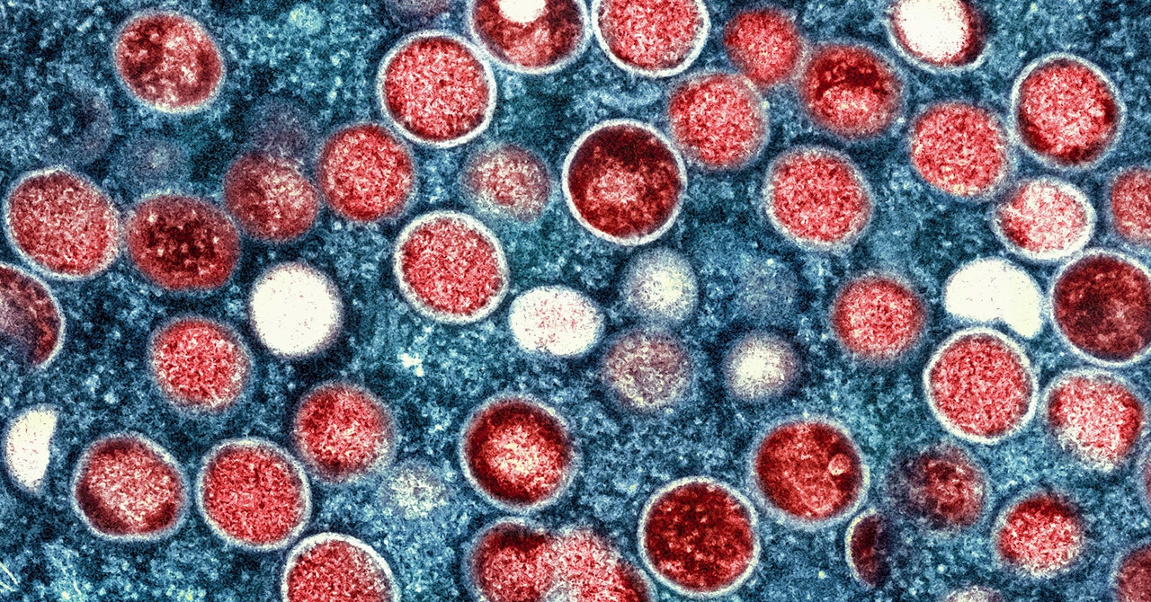 Wired: 3 scenarii viitoare pentru epidemia de variola maimuței