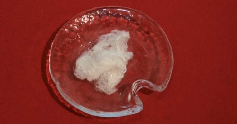 (Green Start-Up: Inovația care ne poate ajuta să captăm emisiile pentru a avea haine cool