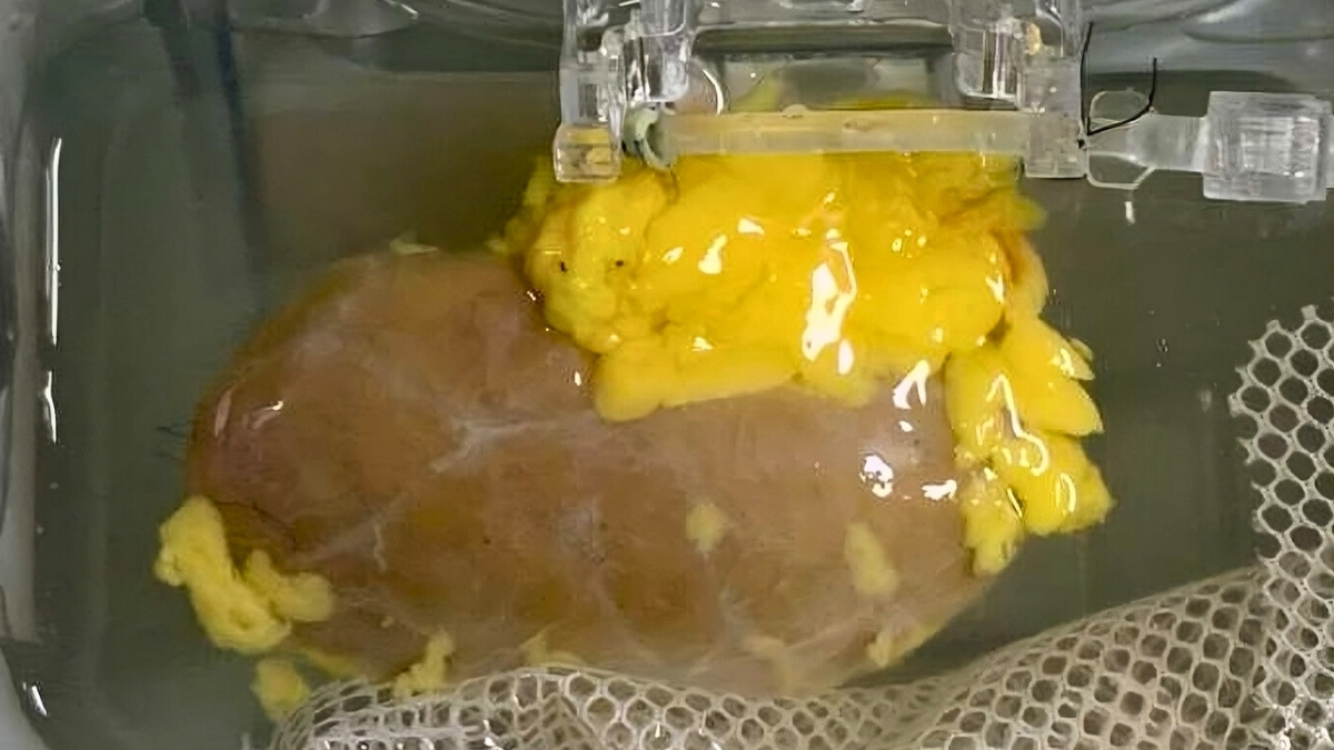 Science Alert: Cercetătorii care au creat un rinichi compatibil cu toate tipurile de sânge