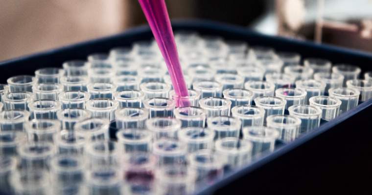 green.start-up.ro: Cum putem produce insulină cu ajutorul emisiilor de carbon captate