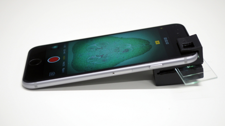 Telefonul tău se poate transforma în microscop