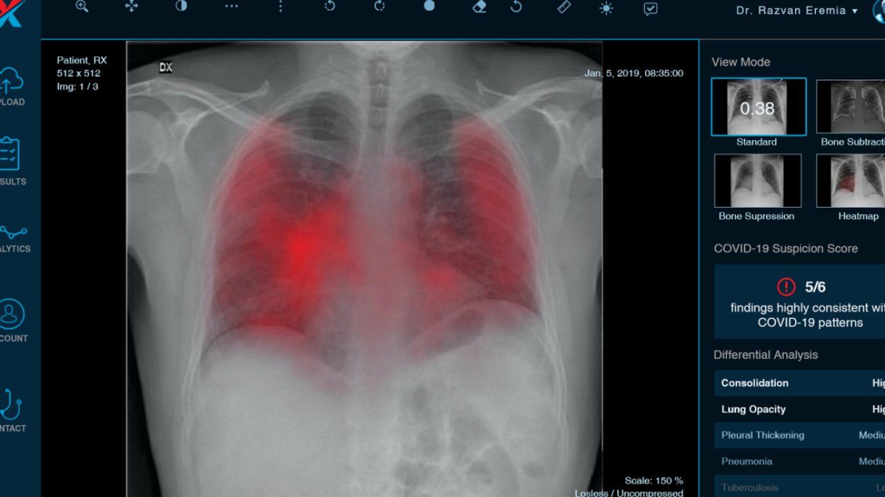 Startup-ul XVision, parteneriat cu CJ Timiș pentru detectarea Covid-19