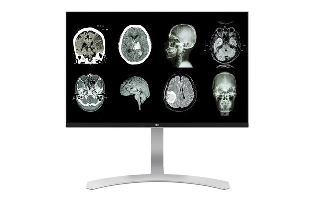 Importanța monitorului medical pentru un diagnostic precis