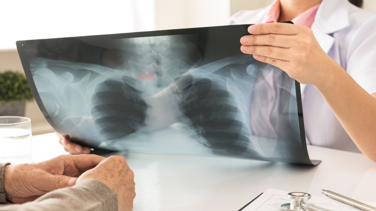 Compania MedTech Synaptiq deschide o nouă rundă de finanțare prin SeedBlink