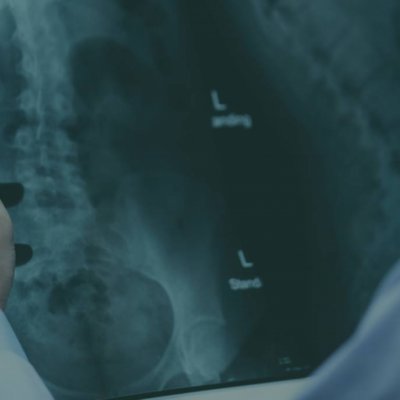 Coronavirus | Medicai, conturi gratuite pentru medici pe platforma de imagistică