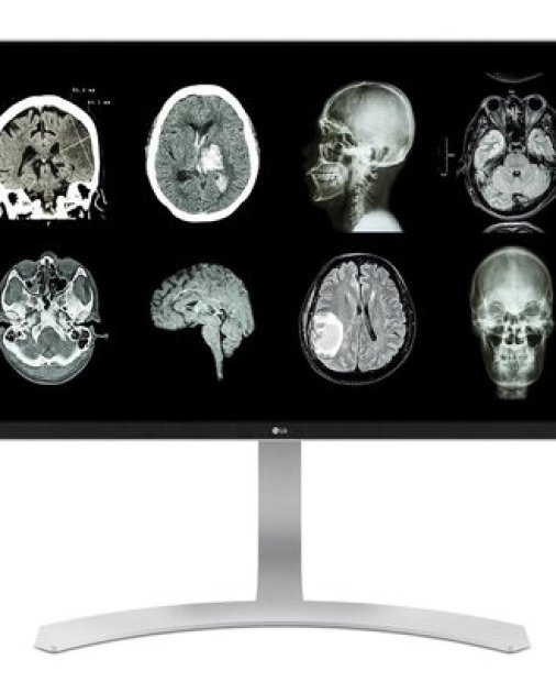 Importanța monitorului medical pentru un diagnostic precis