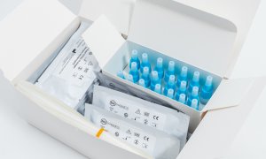 DDS Diagnostic lansează testul rapid Covid-19 Antigen: Rezultate în 15 minute