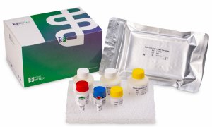 Kit pentru detecția anticorpilor SARS-CoV-2 IgG, exclusiv pentru diagnostic in vitro