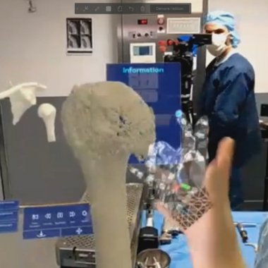 Ochelarii de realitate mixtă HoloLens 2 (Microsoft), utilizați în sala de operații
