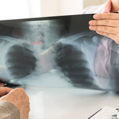 Compania MedTech Synaptiq deschide o nouă rundă de finanțare prin SeedBlink