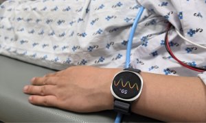 Studiu: Samsung Galaxy Watch 6 poate anticipa episoadele de leșin