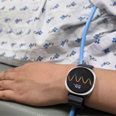 Studiu: Samsung Galaxy Watch 6 poate anticipa episoadele de leșin