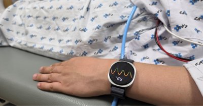 Studiu: Samsung Galaxy Watch 6 poate anticipa episoadele de leșin